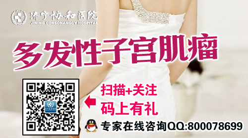 多发性子宫肌瘤